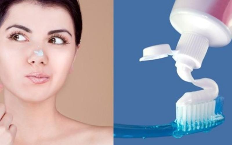 trị mụn bằng kem